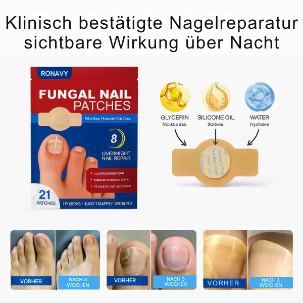 Anti-Pilz-Nagelpflaster