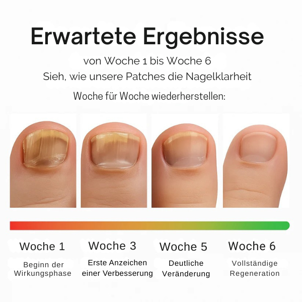 Anti-Pilz-Nagelpflaster